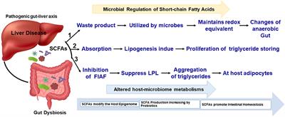 Recent Trends of Microbiota-Based Microbial Metabolites Metabolism in Liver Disease